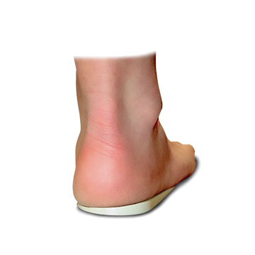 Heel Wedge by Core Products - Small - (Women's up to 8)