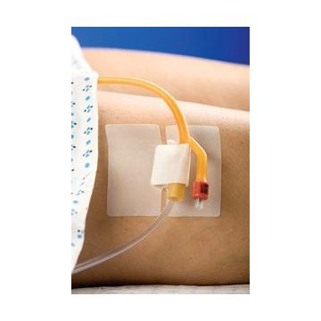 Cath-Secure Multi Purpose Tube Holder, Large Lumen, Adhesive by M.C. Johnson - Each