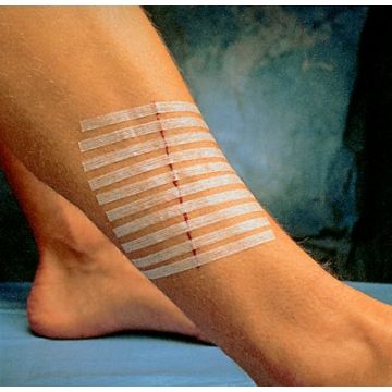 Skin Closure Strip Suture Strip - Box - Box of 50, 1/4 X 3 Inch
